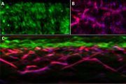 PA microscopy